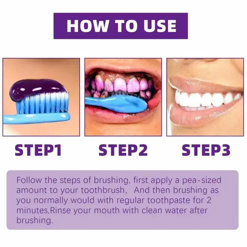 SmileKit V34 Purple Whitening Toothpaste – 30ml